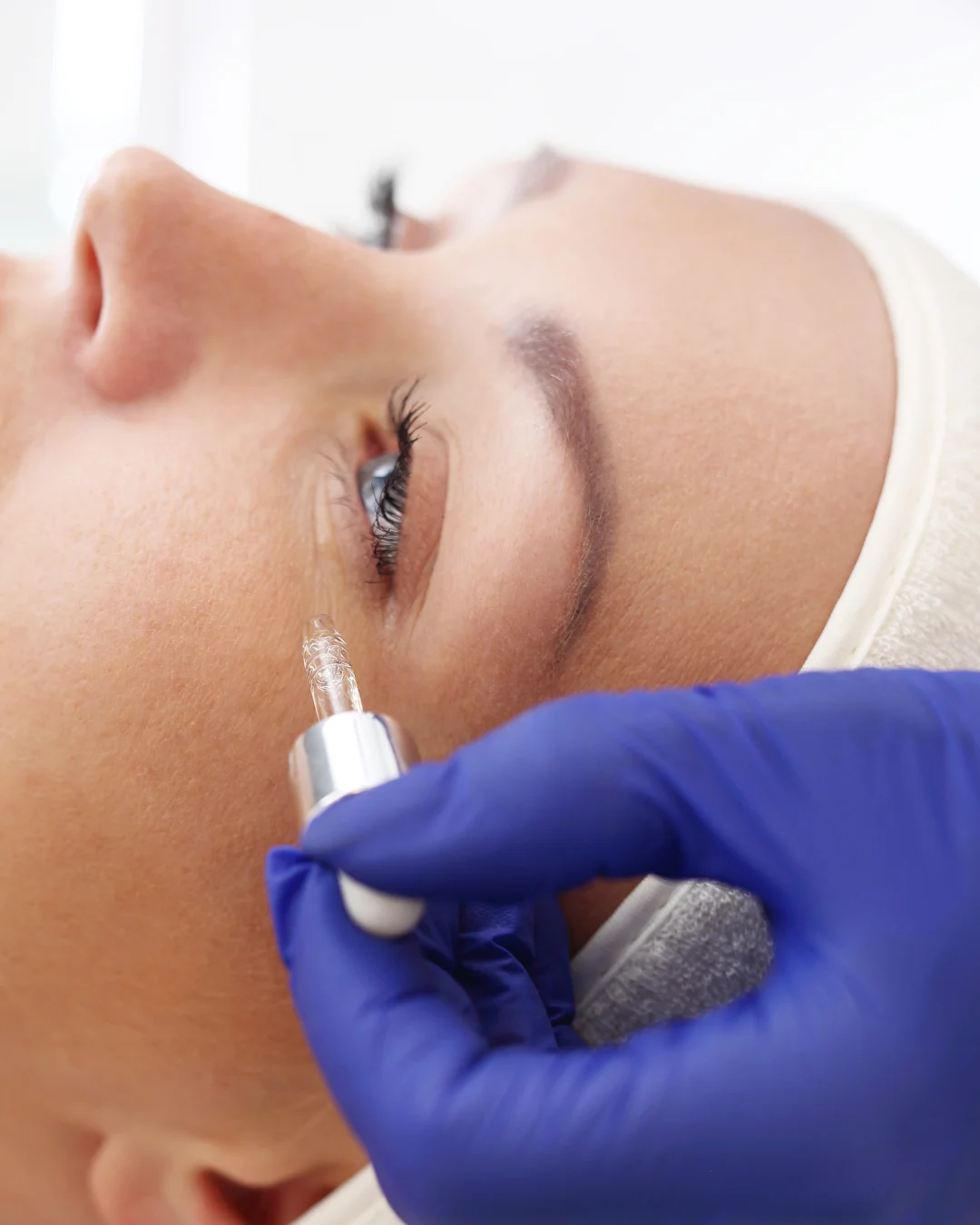 Prévenir les rides de la patte d’oie avec des actifs et cosmétiques adaptés au contour des yeux