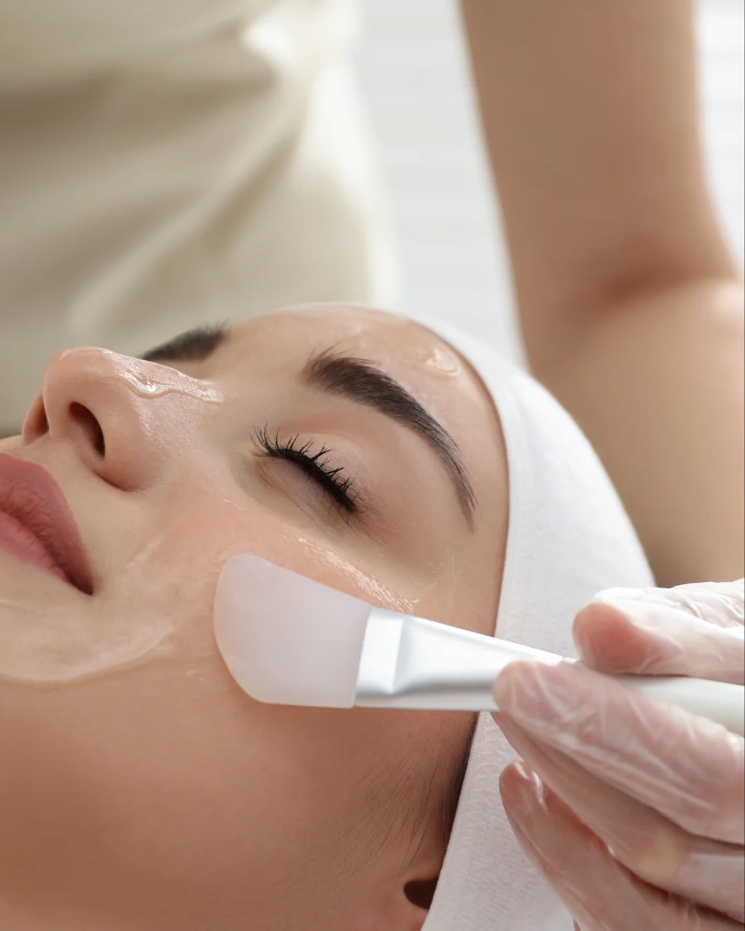 Peeling TCA pour améliorer la texture, l’éclat et la qualité de la peau