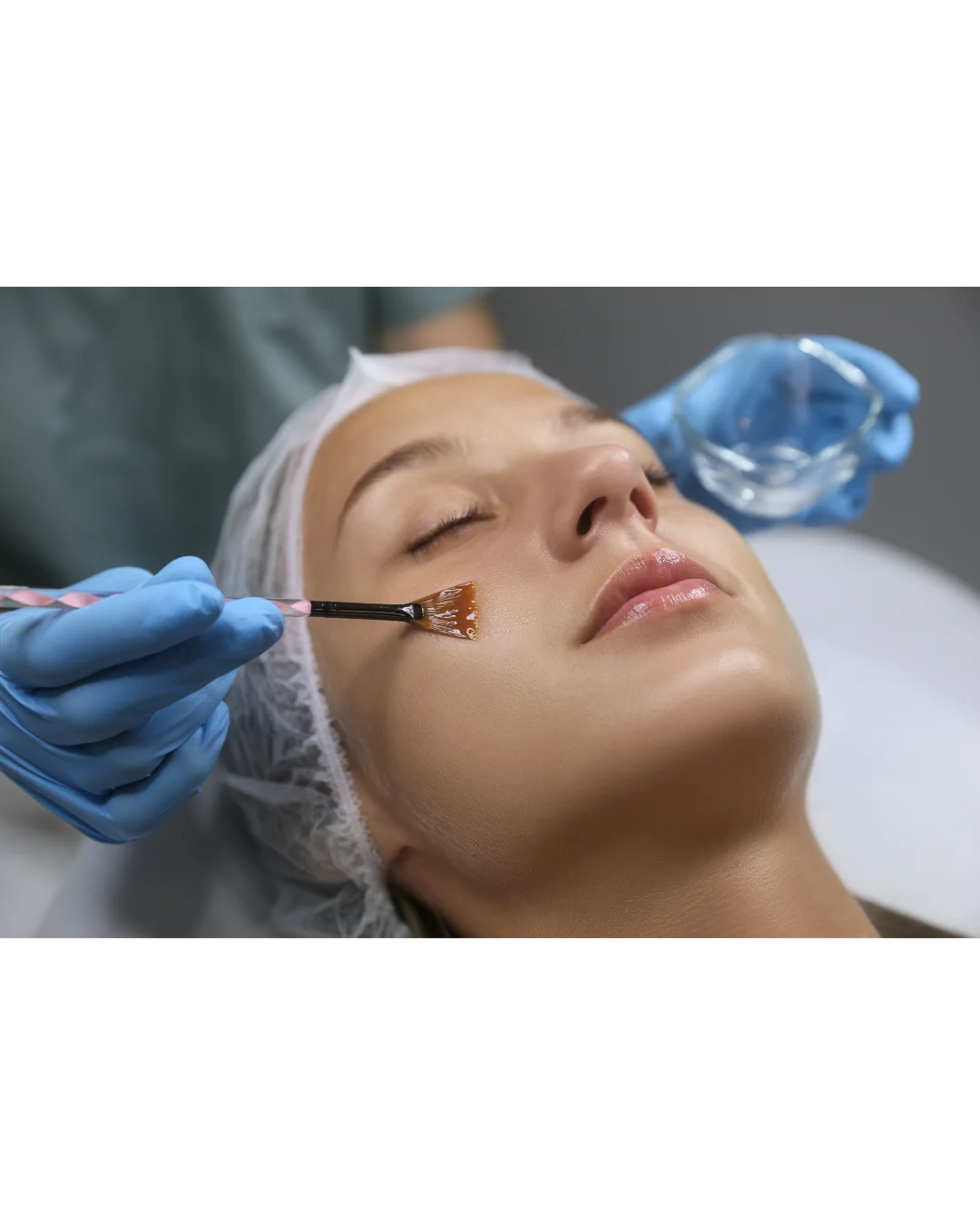 Séance de peeling pour stimuler le collagène et améliorer la qualité de la peau