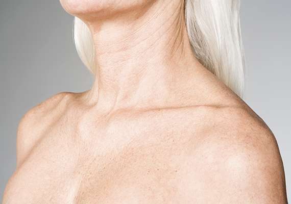 comment enlever les taches brunes et les ridules sur le décolleté