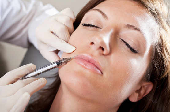 botox-bouche-Centre Laser Nice