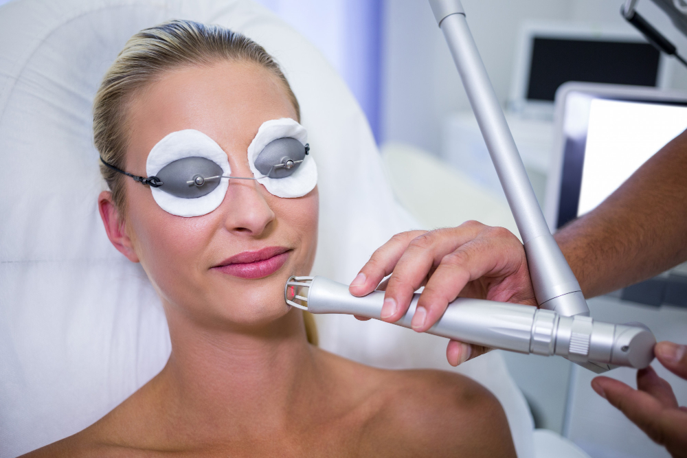 traitement laser rosacee couperise efficace rougeurs visage nice cannes esthetique vasculaire